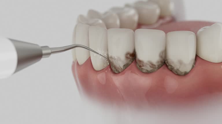 Reliable Dental contractor in Georgetown, OH by Dentist Open Now